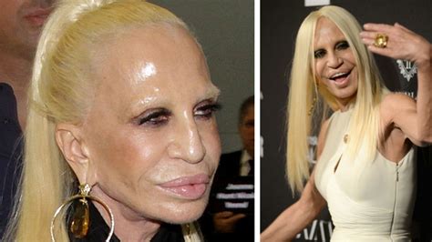 donatella versace operacje|Donatella Versace.